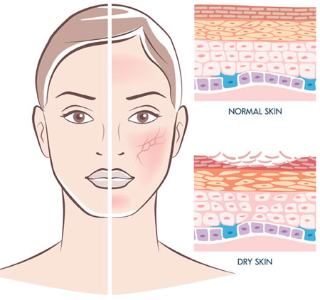 Diagram of humidity and the effects on skin